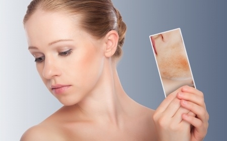 La dermatitis atópica: causas, síntomas y tratamiento